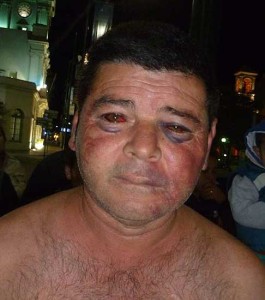 Las lesiones de López, el día después de la brutal agresión.
